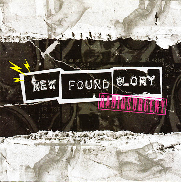 NEW FOUND GLORY – NEW FOUND GLORY – RADIOSURGERY
